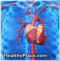 تحديد وإدارة المرضى الذين يعانون من ارتفاع مخاطر عدم انتظام ضربات القلب أثناء العلاج بالتعديل الكهربائي - ECT-.