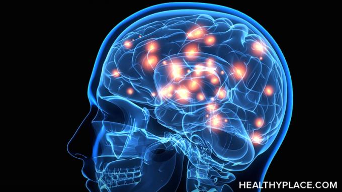 كيف يختلف داء باركنسون عن دماغه؟ تعرف على كيفية تأثير مرض باركنسون على الدماغ وما يظهر على فحص الدماغ ، هنا في HealthyPlace. 